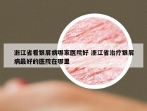 浙江省看银屑病哪家医院好 浙江省治疗银屑病最好的医院在哪里