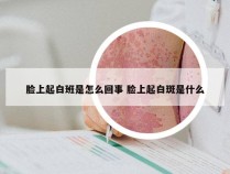 脸上起白班是怎么回事 脸上起白斑是什么