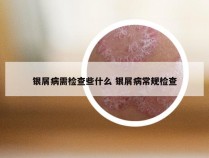 银屑病需检查些什么 银屑病常规检查