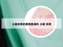 小腿白斑的原因造成的 小腿 白斑