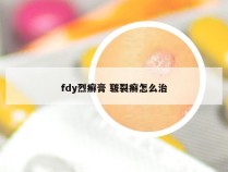 fdy烈癣膏 皲裂癣怎么治