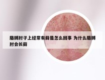 胳膊肘子上经常有藓是怎么回事 为什么胳膊肘会长藓