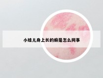 小娃儿身上长的癣是怎么同事