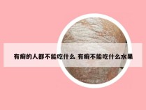 有癣的人都不能吃什么 有癣不能吃什么水果