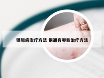 银翘病治疗方法 银翘有哪些治疗方法