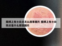 胳膊上有小白点怎么回事图片 胳膊上有小白斑点是什么原因图片