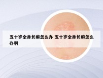 五十岁全身长癣怎么办 五十岁全身长癣怎么办啊