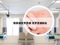 银屑病克罗恩病 克罗恩病别名