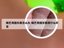 嘴巴周围长癣怎么办 嘴巴周围长癣用什么药膏