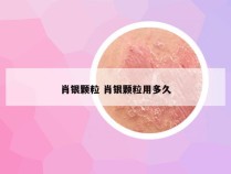 肖银颗粒 肖银颗粒用多久