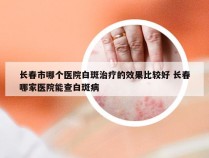 长春市哪个医院白斑治疗的效果比较好 长春哪家医院能查白斑病