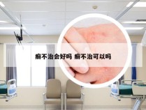 癣不治会好吗 癣不治可以吗