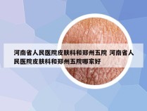 河南省人民医院皮肤科和郑州五院 河南省人民医院皮肤科和郑州五院哪家好