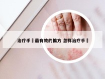 治疗手廯最有效的偏方 怎样治疗手婬