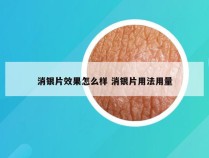 消银片效果怎么样 消银片用法用量