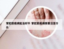 掌跎脓疱病能治好不 掌跎脓疱病需要注意什么