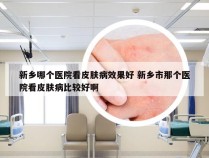 新乡哪个医院看皮肤病效果好 新乡市那个医院看皮肤病比较好啊