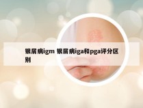 银屑病igm 银屑病iga和pga评分区别