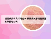 银屑病关节炎打阿达木 银屑病关节炎打阿达木单抗可以吗