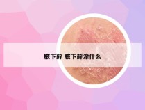 腋下藓 腋下藓涂什么