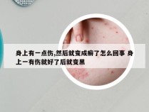 身上有一点伤,然后就变成癣了怎么回事 身上一有伤就好了后就变黑