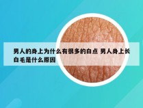 男人的身上为什么有很多的白点 男人身上长白毛是什么原因