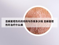 百癣夏塔热片的功效与作用多少钱 百癣夏塔热片治疗什么病