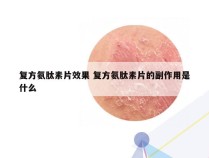 复方氨肽素片效果 复方氨肽素片的副作用是什么