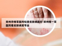 郑州市哪家医院检查皮肤病最好 郑州哪一家医院看皮肤病更专业