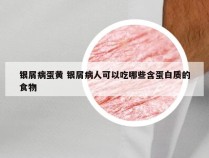 银屑病蛋黄 银屑病人可以吃哪些含蛋白质的食物