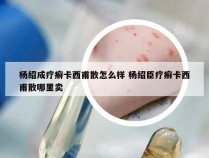 杨绍成疗癣卡西甫散怎么样 杨绍臣疗癣卡西甫散哪里卖