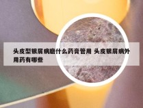 头皮型银屑病磨什么药膏管用 头皮银屑病外用药有哪些