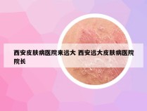 西安皮肤病医院来远大 西安远大皮肤病医院院长