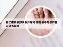 得了银屑病部队会开除吗 银屑病不是很严重可以当兵吗