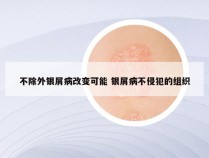 不除外银屑病改变可能 银屑病不侵犯的组织