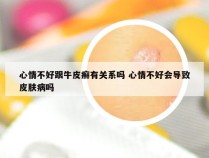 心情不好跟牛皮癣有关系吗 心情不好会导致皮肤病吗