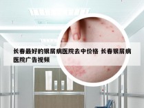 长春最好的银屑病医院去中价格 长春银屑病医院广告视频