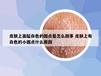 皮肤上面起白色的圆点是怎么回事 皮肤上有白色的小圆点什么原因