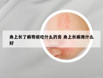 身上长了癣奇痰吃什么药膏 身上长癣用什么好