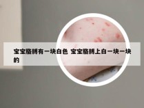 宝宝胳膊有一块白色 宝宝胳膊上白一块一块的