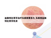 盐酸特比萘芬治疗头癣需要多久 头癣用盐酸特比萘芬乳膏