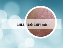 主图上牛皮癣 主图牛皮廨