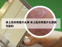 身上出白斑是什么病 身上起白斑是什么原因引起的