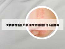 生物制剂治什么病 用生物制剂有什么副作用