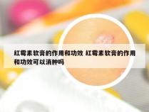 红霉素软膏的作用和功效 红霉素软膏的作用和功效可以消肿吗