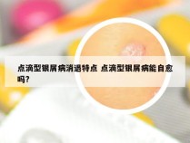 点滴型银屑病消退特点 点滴型银屑病能自愈吗?