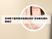 宣城哪个医院看皮肤病比较好 宣城看皮肤科哪里好