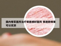 国内哪家医院治疗银翘病好医院 银翘散哪里可以买到