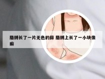 胳膊长了一片无色的藓 胳膊上长了一小块像癣