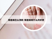 银翘病怎么预防 银翘病用什么药好使